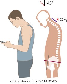 Neck angle and load when looking at a smartphone, tilt 45 degrees