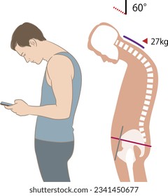 Neck angle and load when looking at a smartphone, tilt 60 degrees