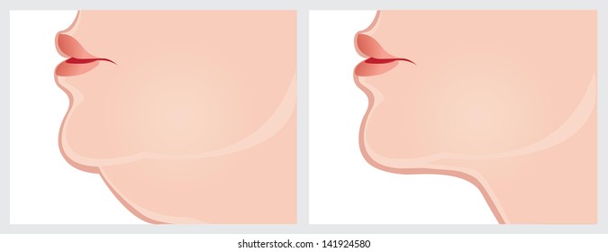 neck before and after. Vector image on a white background. Scroll down to see more of my designs linked below.