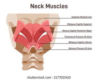 Neck muscles back view. Didactic scheme of anatomy of human muscular system with anatomical captions. Splenius capitis and splenius cervicis. Flat vector illustration