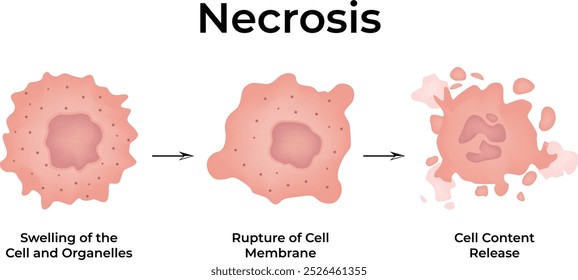 Desenvolvimento de câncer de necrose Ilustração de vetor celular de câncer de células normais