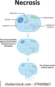 Necrosis Diagram