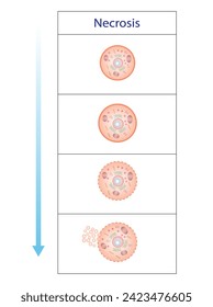 Necrosis, Muerte de Células Patológicas, Muerte de los tejidos corporales, Lesiones celulares que resultan en la muerte prematura de células en el tejido vivo por autólisis.