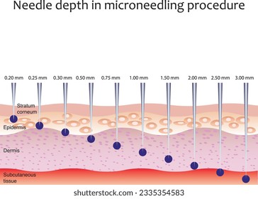 Needle depth in micro needling treatment. Skin layers and needles injection.