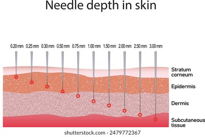 Needle depth in skin. Cosmetology procedure. Micro needling. Different size of needles.