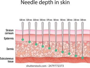 Needle depth in skin. Cosmetology procedure. Microneedling