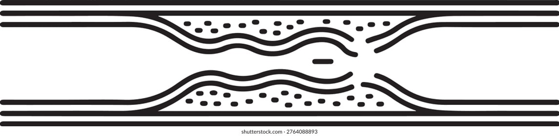 Negative changes inside the vessel in diabetes mellitus. The accumulation of cholesterol and calcium in the walls of arteries leads to disruption of blood supply to tissues. one line art icon drawing vector
