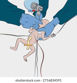Intervención neonatal, intubación en urgencias.