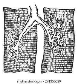 Nerve ending in muscle-fibers, vintage engraved illustration.
