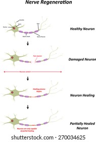 Nerve Regeneration (Healing)