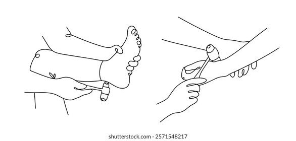 A neurologist checks tendon reflexes in the patient's arms and legs using a medical hammer. Black and white illustration on the theme of medicine. Vector.