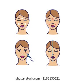 Neurotoxin injection color icons set. Anesthetic cream, facial markup, crows feets injection, facial rejuvenation. Isolated vector illustrations