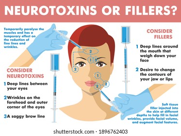 Neurotoxins or fillers. Infographics. Neurotoxin injection. Woman facial wrinkle treatment. Infographics of medical cosmetic procedures for face skin. Botox. Vector Illustration