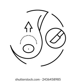 nipple correction surgery line icon vector. nipple correction surgery sign. isolated contour symbol black illustration