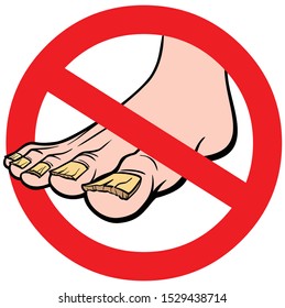 No Nail Fungus - A cartoon illustration of a No Nail Fungus Sign.