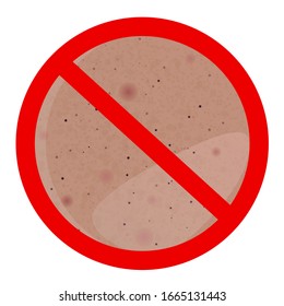 No oily skin: with pimples, black dots and greasy Shine. Suitable for dermatology, medicine and cosmetology. Vector illustration on a separate background.