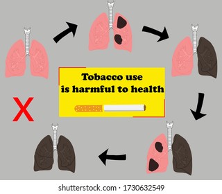 No Tobacco, Representing The Deterioration Of The Lungs Due To Tobacco Use, With The Phrase, Tobacco Use Is Harmful To Health