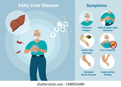 Non Alcoholic Fatty Liver Disease Symptoms. Old Man Suffering From Upper Right Abdomen Pain Caused By Fatty Liver. Medical And Healthcare Awareness Concept.