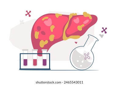 Non-alcoholic fatty liver NAFLD or steatohepatitis, flat vector illustration isolated on white background. Human liver with fatty deposits, precancerous condition.