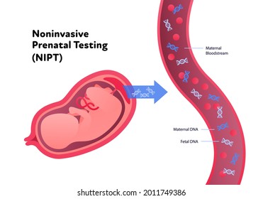 Noninvasive Parental Testing NIPT Concept. Vector Flat Healthcare Illustration. Genetic Test. Baby In Womb, Blood Vessel, Dna Spiral Symbol. Design For Healthcare, Pharmacy, Family Planning