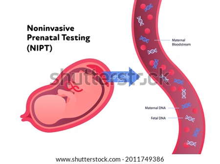 Noninvasive parental testing NIPT concept. Vector flat healthcare illustration. Genetic test. Baby in womb, blood vessel, dna spiral symbol. Design for healthcare, pharmacy, family planning