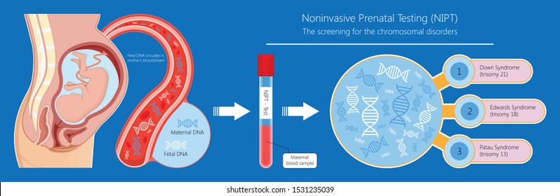 Noninvasive prenatal testing NIPT screening genetic disorders bloodstream cfDNA lab plus diagnostic diagnose 21 18 13 cell free chromosomal NIFTY exam simple pregnancy