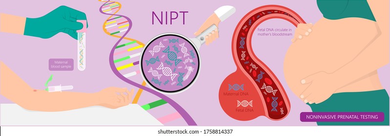 Noninvasive Prenatal Testing NIPT Screening Genetic Disorders Bloodstream CfDNA Lab Plus Diagnostic Diagnose 21 18 13 Cell Free Chromosomal NIFTY Exam Simple Pregnancy