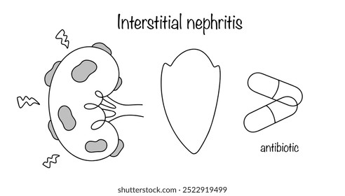 Um processo inflamatório inespecífico e atípico nos rins, que é resistente à terapia antibiótica tradicional. Uma simples ilustração em preto e branco sobre um tema médico. Ilustração vetorial.