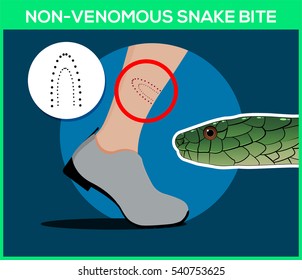 Non-venomous snake bite in the leg, beware of snakes.