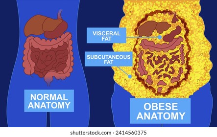 Normal anatomy vs obese anatomy. Body fat problems. Banner, snippet. Healthcare illustration. Vector illustration. 