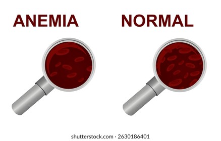 Normal e ícone de anemia. vetor