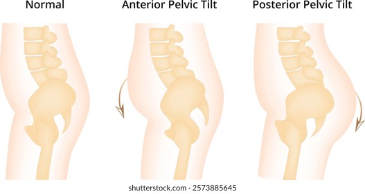 Normal Anterior Pelvic Tilt Posterior Tilt Science Design Vector Illustration Diagram