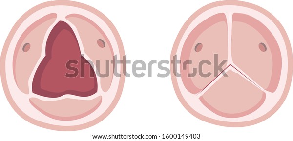 Normal Aortic Valve Human Anatomy Aortic Stock Vector Royalty