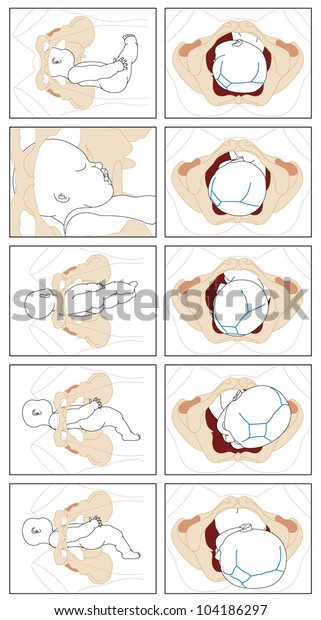 Normal Birth Showing Detail Fetal Movement Stock Vector Royalty Free