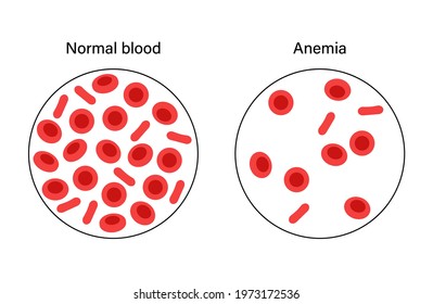 140 Hematocrit structure Images, Stock Photos & Vectors | Shutterstock