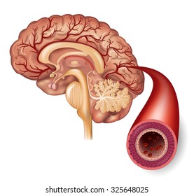 Normal Brain And Artery Structure Detailed Illustration