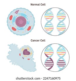 Normal and cancer cells. Difference between healthy tissue and tumor cell structure and DNA. Pathological malignancy cells with genome instability. Flat vector illustration