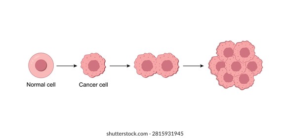 Normal cell and cancer cells. Cancer development. Carcinogens, DNA damage. Malignant tumor. Difference between normal and tumor cells. Scientific design. Vector Illustration.


