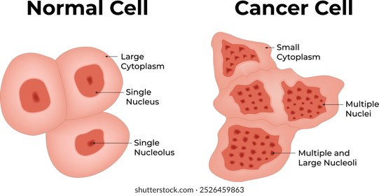 Célula Normal Câncer Célula Grande Citoplasma Único Núcleo Único Ilustração de Vetor de Núcleo Único