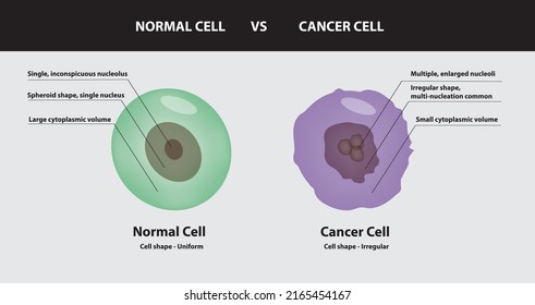 Normal Cell Vs Cancer Cell, Differences In Terms Of Cell Shape, Nucleus, Nucleolus, Cytoplasm, Vector, Illustration,