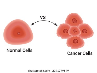 Células normales y células cancerosas Diseñan Ilustración Científica Vector