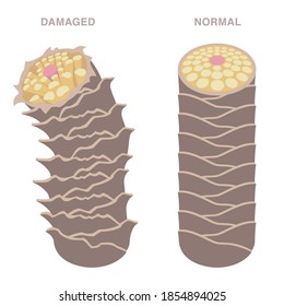 Normal And Damaged Hair. Smooth And Damaged Cuticle. Pale Colored Illustration. 