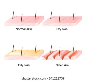 Normal, Dry And Oily, Younger And  Older Skin. Different. Human Skin Types And Conditions. Sectional View. 