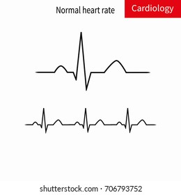 Normal ECG complex and normal sinus rhythm.Vector illustration.