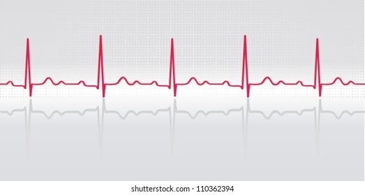 Normal electrocardiogram human in the background on the polished surface. Simulation of volume. Vector illustration.