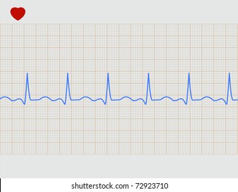 Normal electronic cardiogram. EPS 8 vector file included