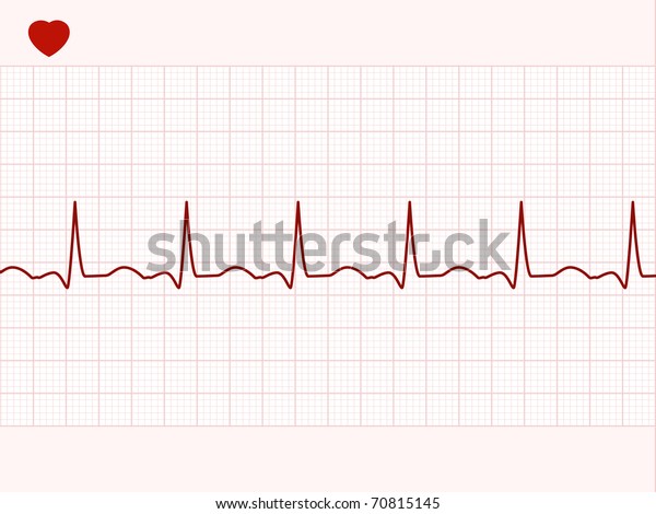 Normal Electronic Cardiogram Eps 8 Vector Stock Vector (Royalty Free ...