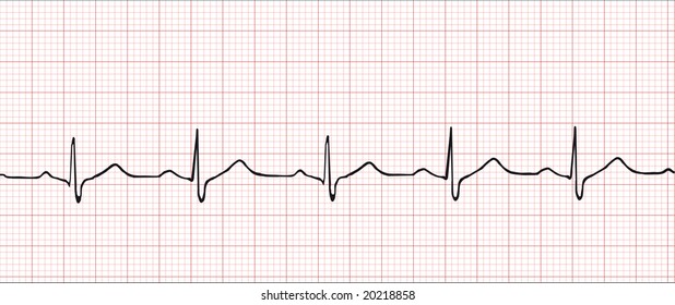 Normal electronic cardiogram vector illustration