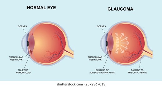 normal eye glaucoma eyes anatomy vector flat design