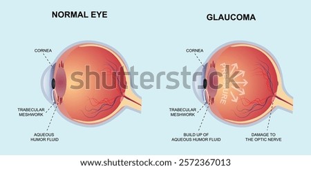 normal eye glaucoma eyes anatomy vector flat design